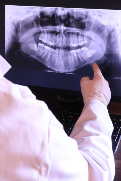 Best Emergency Treatment for Dental Infections or Abscesses in Livingston, CA
