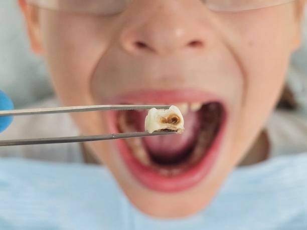 Best Emergency Denture Repair in Livingston, CA