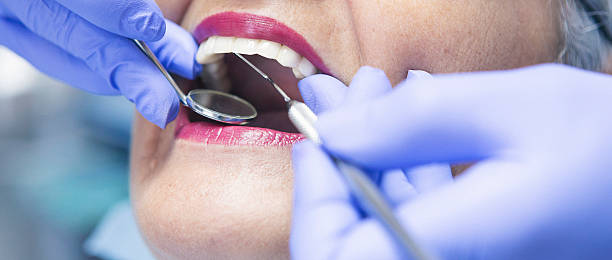 Best Emergency Gum Treatment in Livingston, CA